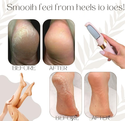 Smooth Feet in Minutes – Waterproof & Rechargeable Foot File