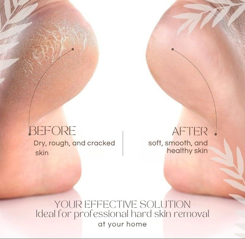 Smooth Feet in Minutes – Waterproof & Rechargeable Foot File