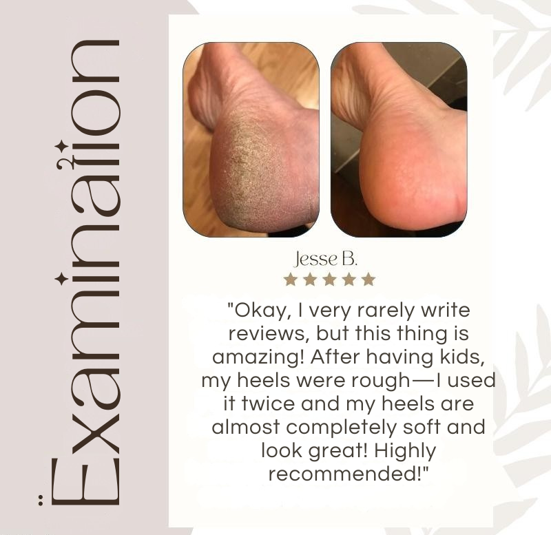 Smooth Feet in Minutes – Waterproof & Rechargeable Foot File