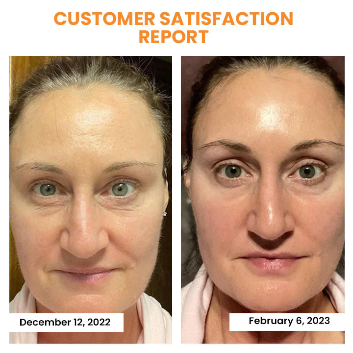 YouthGlow™ | Transformative Soluble Collagen Film for Skin Rejuvenation