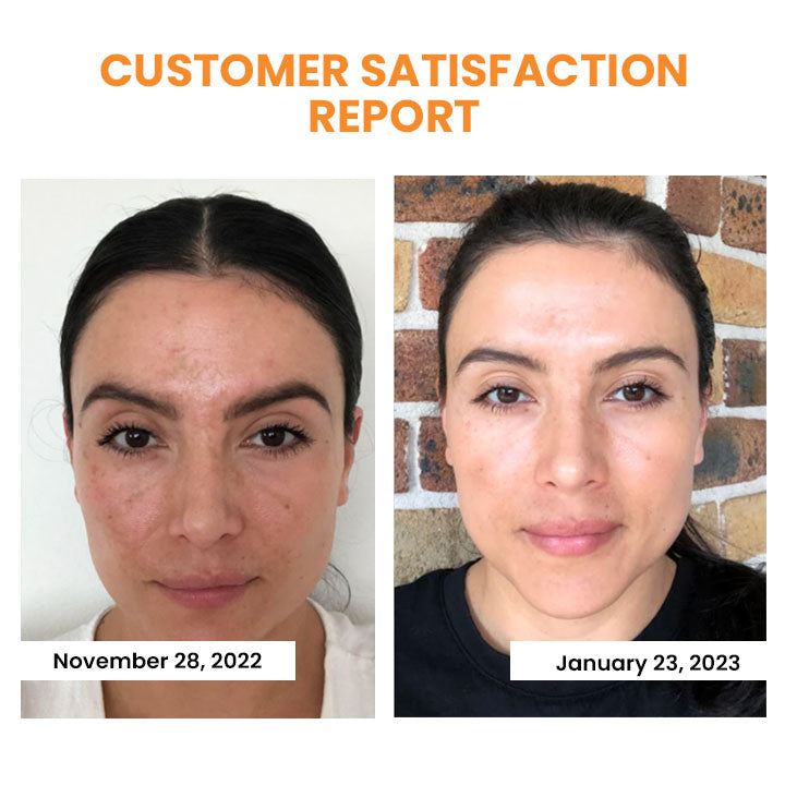 YouthGlow™ | Transformative Soluble Collagen Film for Skin Rejuvenation