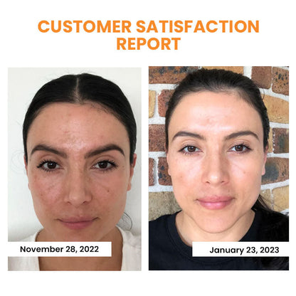 YouthGlow™ | Transformative Soluble Collagen Film for Skin Rejuvenation