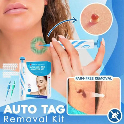 Mole Removal Kit for Skin - Eliminate Auto Skin Moles