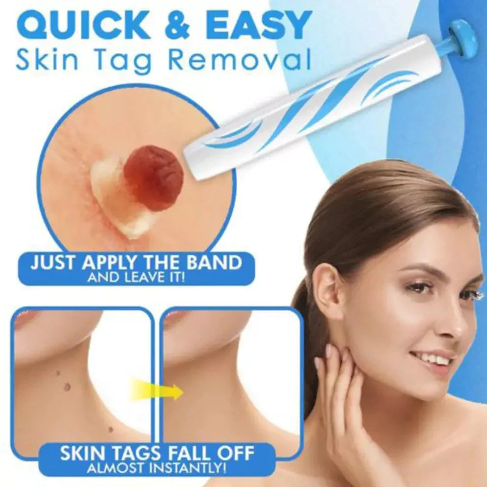 Mole Removal Kit for Skin - Eliminate Auto Skin Moles