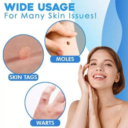 Mole Removal Kit for Skin - Eliminate Auto Skin Moles