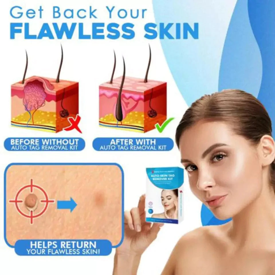 Mole Removal Kit for Skin - Eliminate Auto Skin Moles