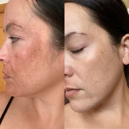 RadianceWave™ – Gentle LED Therapy for Flawless Skin