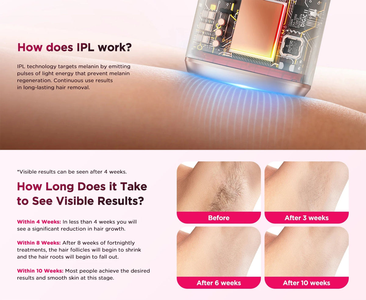 Hair Removal Device with 999,900 Flashes | 9 Energy Settings, Auto-Glide and Skin Sensor