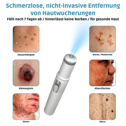 RadiantGlow™ Pain-Free Laser Pen – Reveal Flawless Skin Anytime