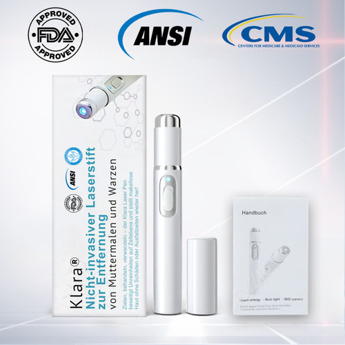 RadiantGlow™ Pain-Free Laser Pen – Reveal Flawless Skin Anytime