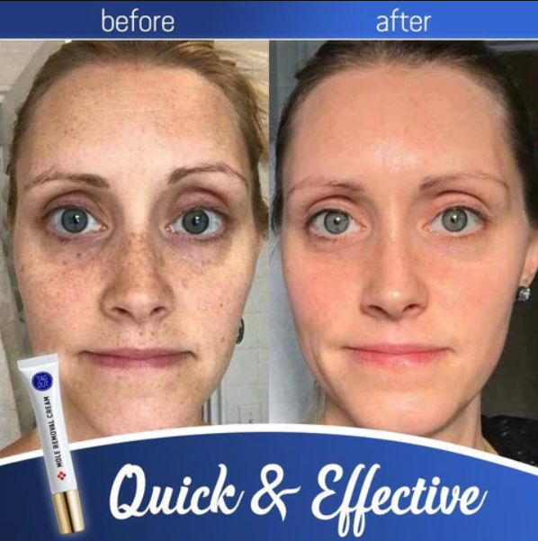 Radiance Elixir - Achieve Flawless Skin Naturally