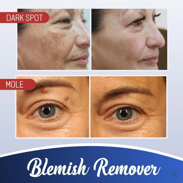 Radiance Elixir - Achieve Flawless Skin Naturally