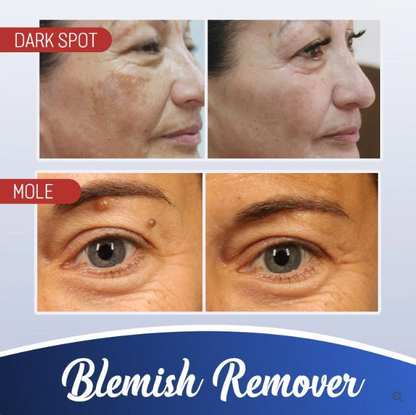 Radiance Elixir - Achieve Flawless Skin Naturally