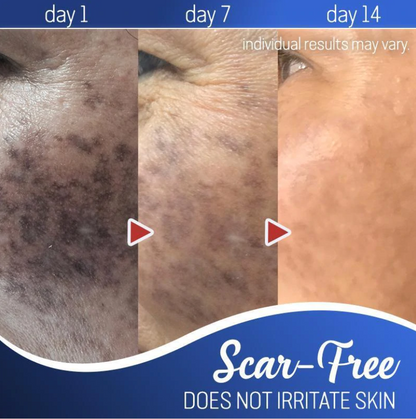 Radiance Elixir - Achieve Flawless Skin Naturally