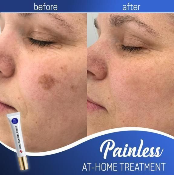 Radiance Elixir - Achieve Flawless Skin Naturally