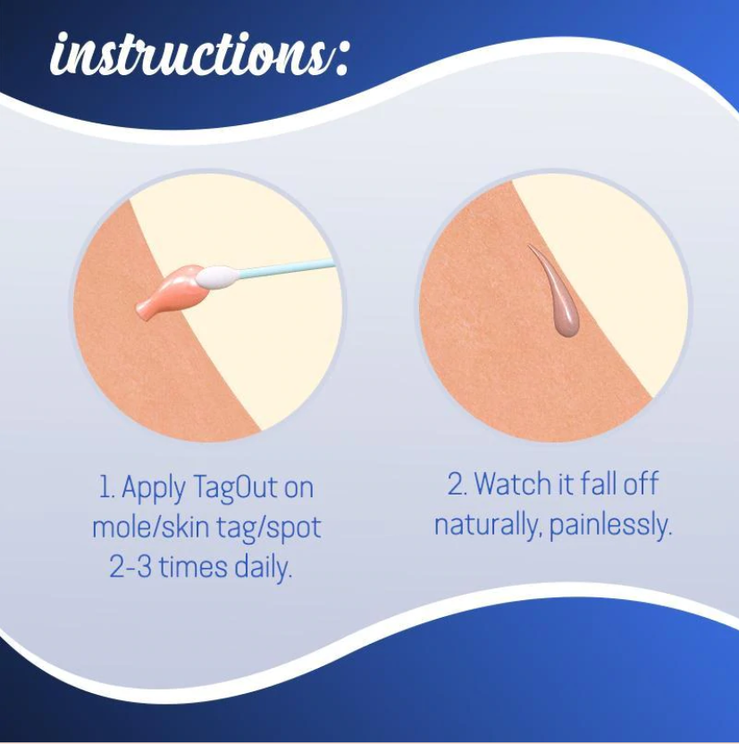 Radiance Elixir - Achieve Flawless Skin Naturally