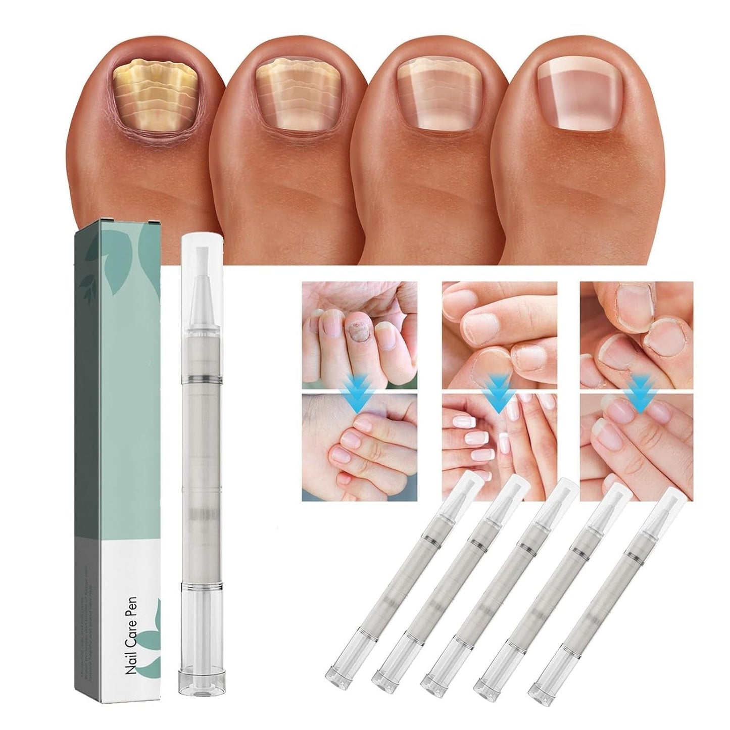 NailRevive® | Ultimate Nail Care Stick