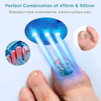 ReviveNail Laser Treatment | Eliminate Nail Fungus Effectively!