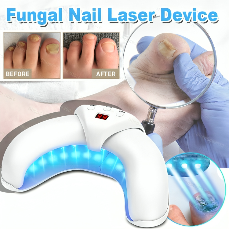 ReviveNail Laser Treatment | Eliminate Nail Fungus Effectively!