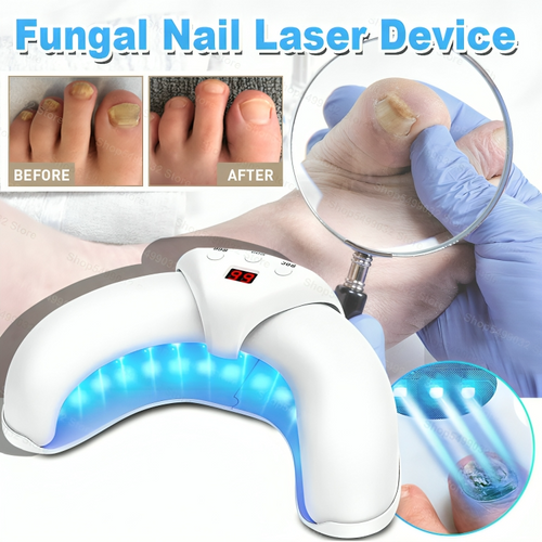 ReviveNail Laser Treatment | Eliminate Nail Fungus Effectively!