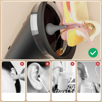 Digital Ear Wax Removal Tool for Ear Hygiene