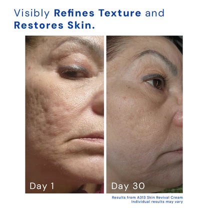 Revitalize Night Cream with Retinol for Radiant Skin