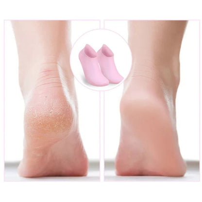 Hydrating Silicone Foot Treatment Socks - 2 Pairs for Soft Heels