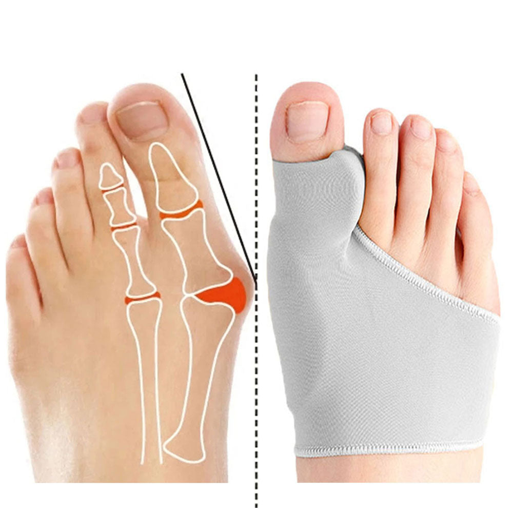 Hallux Valgus Correction - Gel Pad Foot Pain Relief - Toe Separator