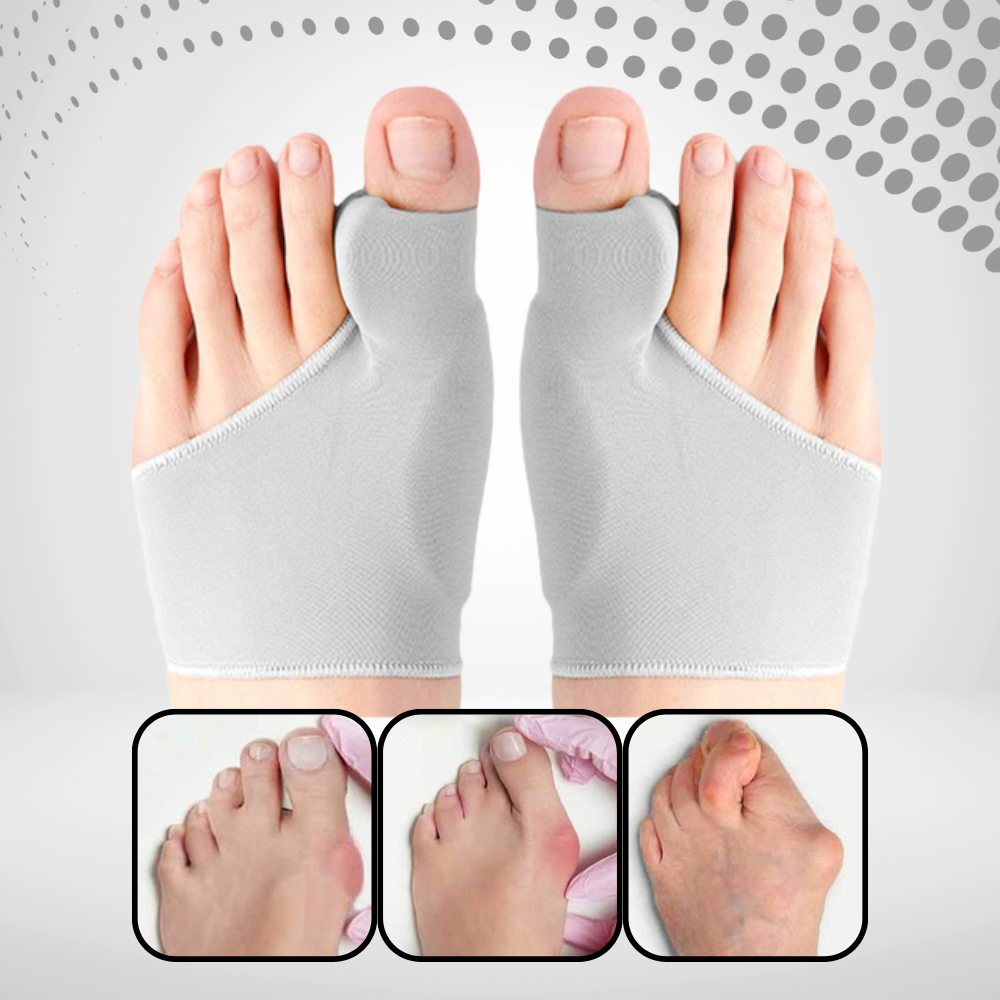 Hallux Valgus Correction - Gel Pad Foot Pain Relief - Toe Separator