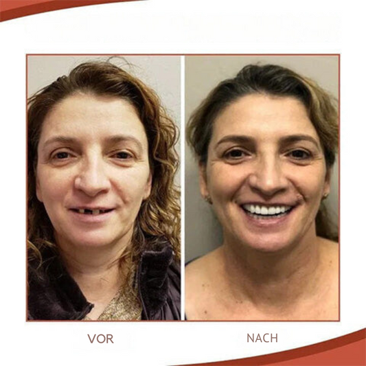 Biocompatible Silicone Denture Kit for Comfortable Fit and Natural Smile