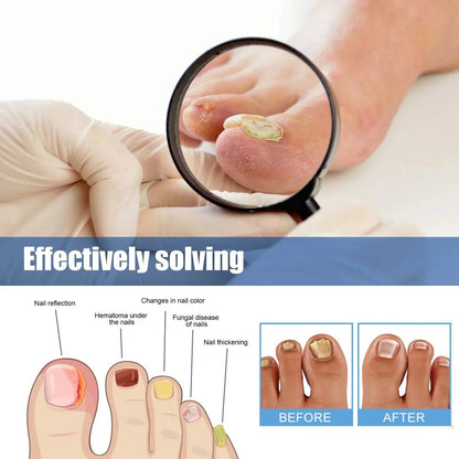 Revitalize Nail Treatment Patches | Overnight Healing Formula