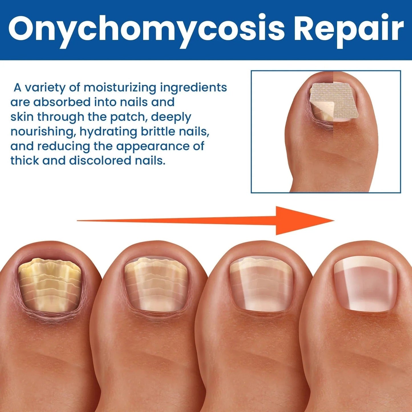 Revitalize Nail Treatment Patches | Overnight Healing Formula