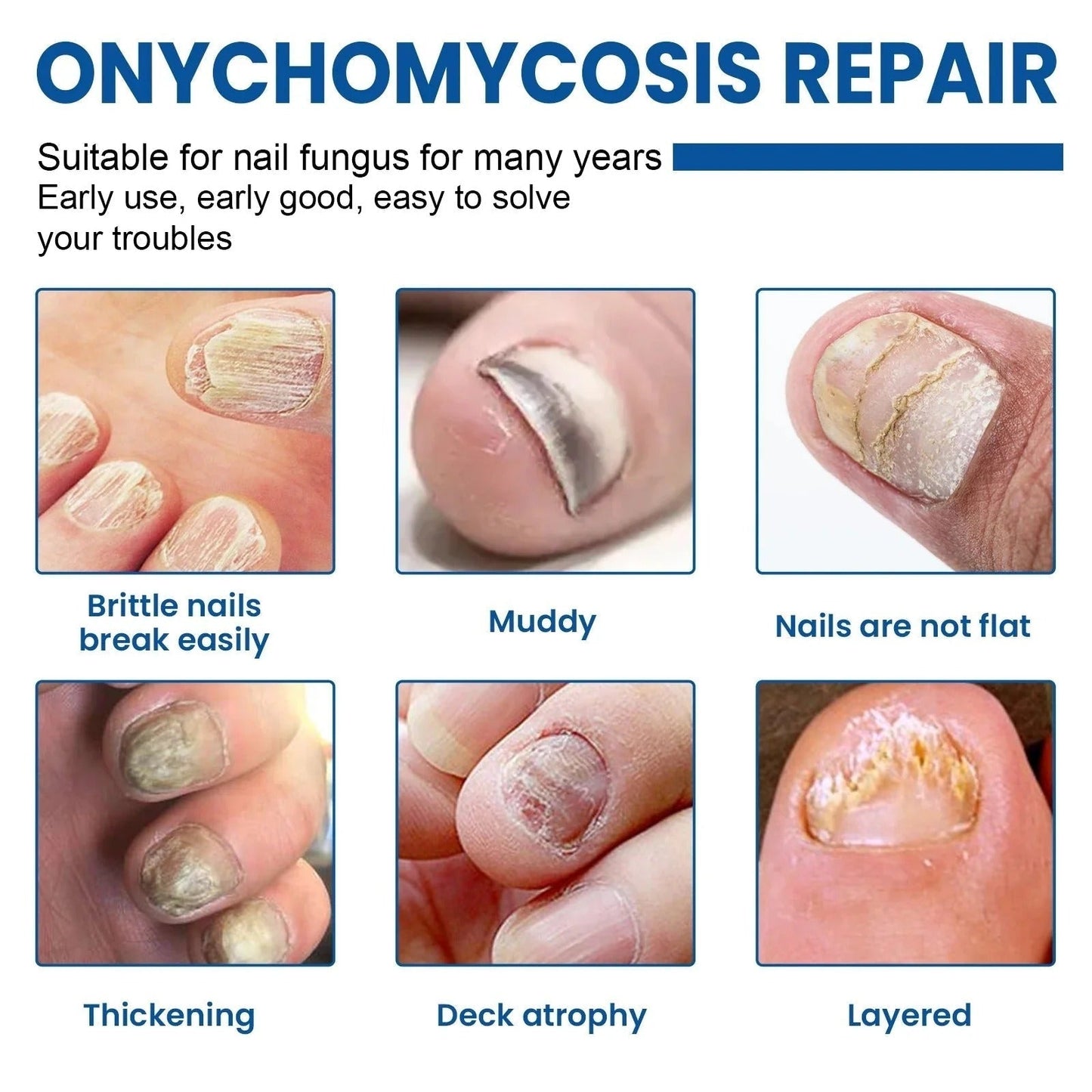 Revitalize Nail Treatment Patches | Overnight Healing Formula