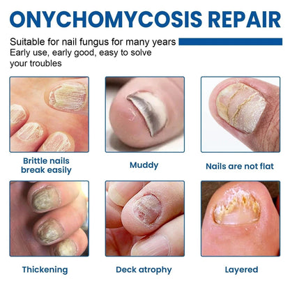 Revitalize Nail Treatment Patches | Overnight Healing Formula