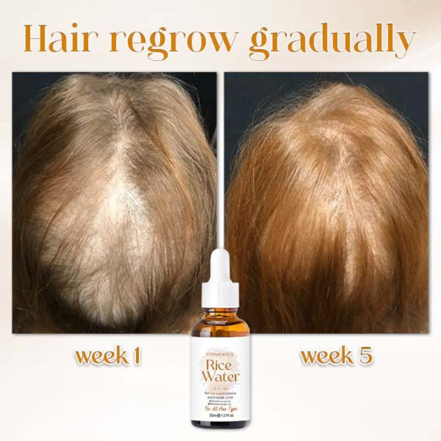Nourish & Flourish | Japanese Fermented Rice Water Hair Serum