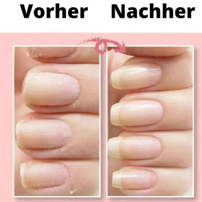 NailRevive™ - Effortlessly Restore Your Nails!