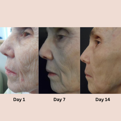 RadiantEyes - Restore Youthful Sparkle to Your Gaze!