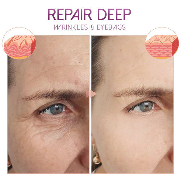 RadiantEyes - Restore Youthful Sparkle to Your Gaze!