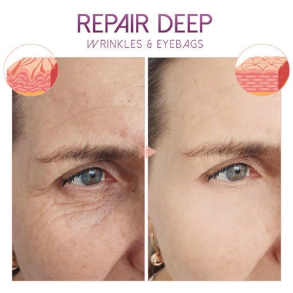RadiantEyes - Restore Youthful Sparkle to Your Gaze!