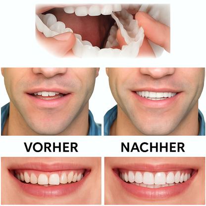 Removable Dental Prosthesis with Adjustable Fit