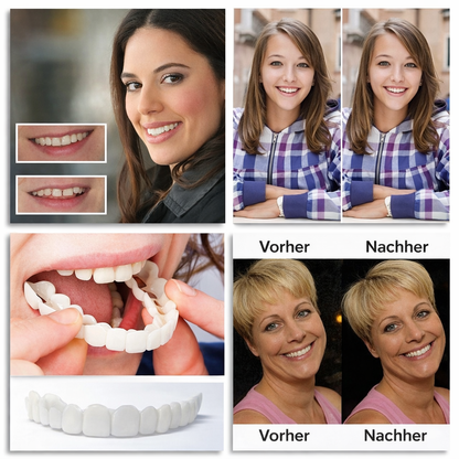 Removable Dental Prosthesis with Adjustable Fit