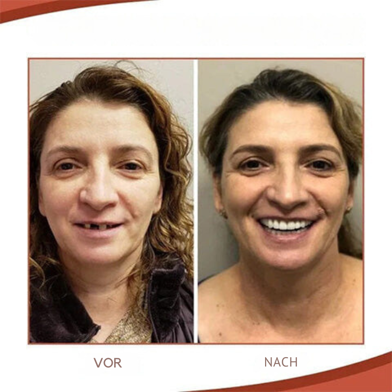ComfortFit Denture Adjustment Kit for a Confident Smile