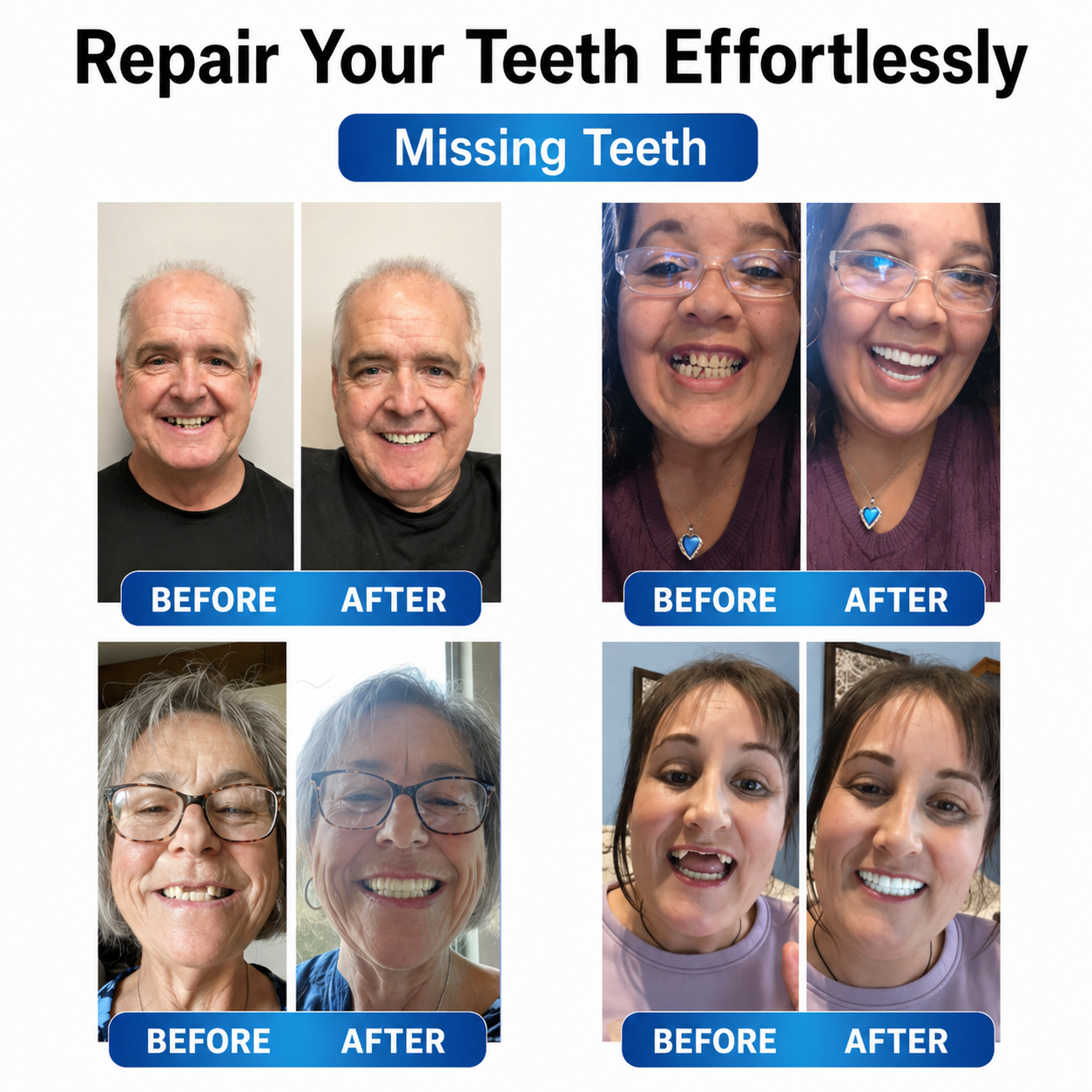 Instant Smile Repair Kit with LED Technology