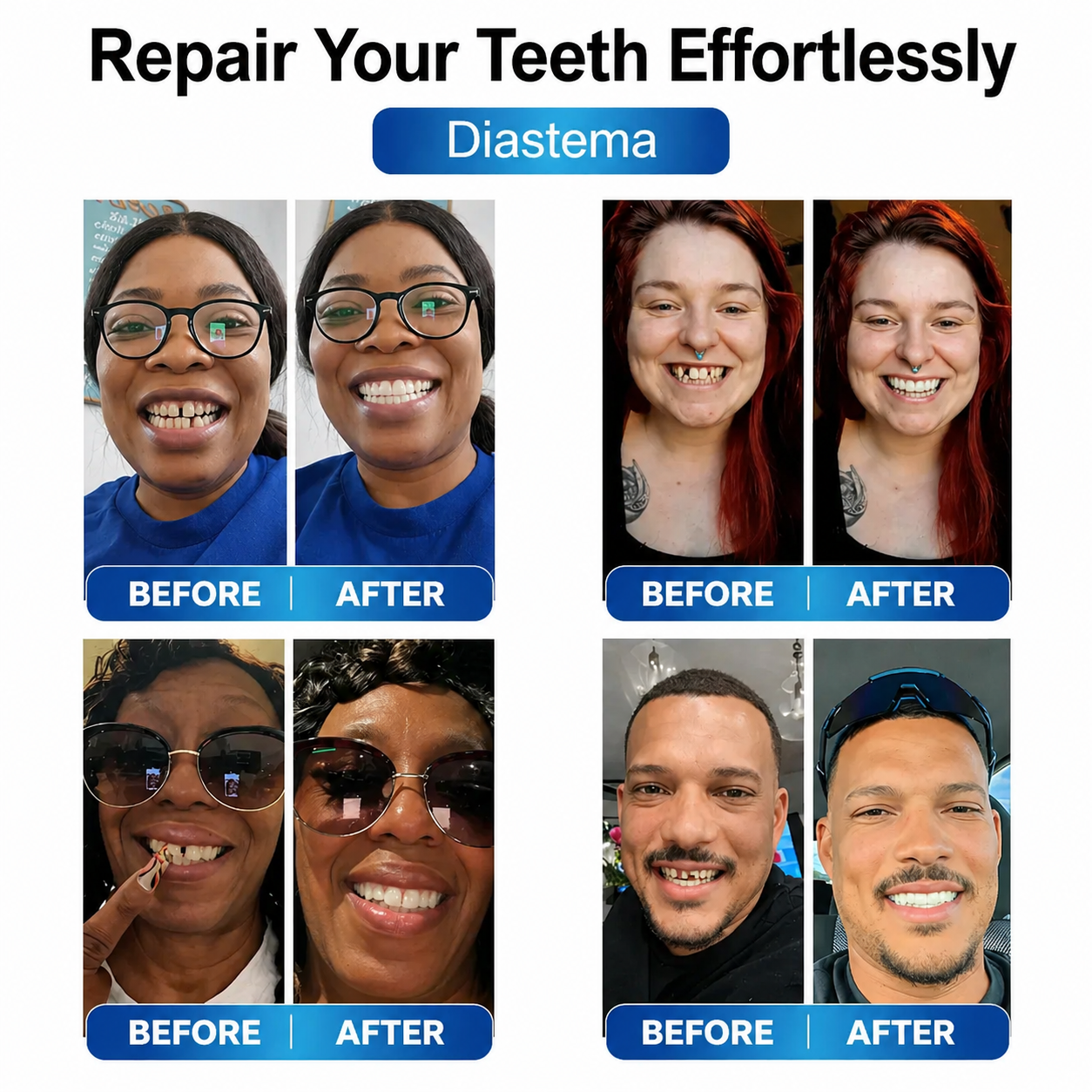 Instant Smile Repair Kit with LED Technology