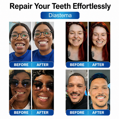 Instant Smile Repair Kit with LED Technology