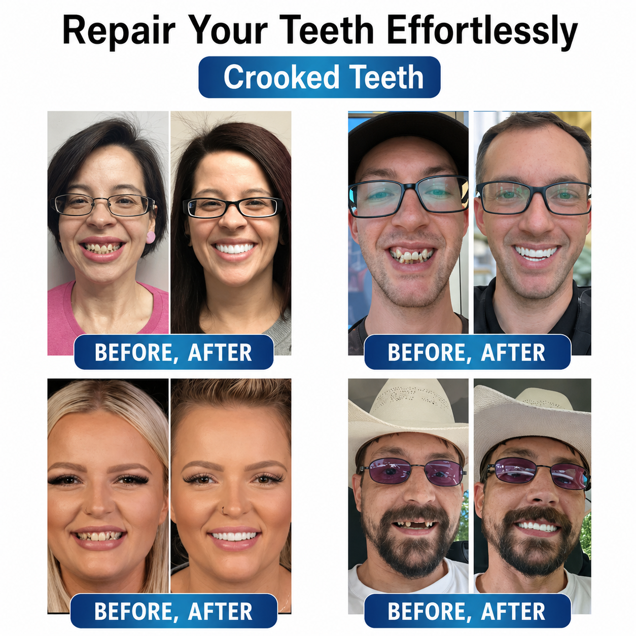 Instant Smile Repair Kit with LED Technology