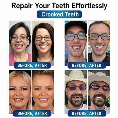 Instant Smile Repair Kit with LED Technology