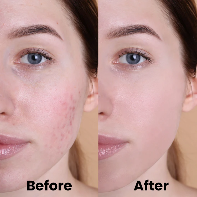 GlowBoost Pads | Turmeric and Kojic Acid Treatment