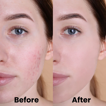 GlowBoost Pads | Turmeric and Kojic Acid Treatment