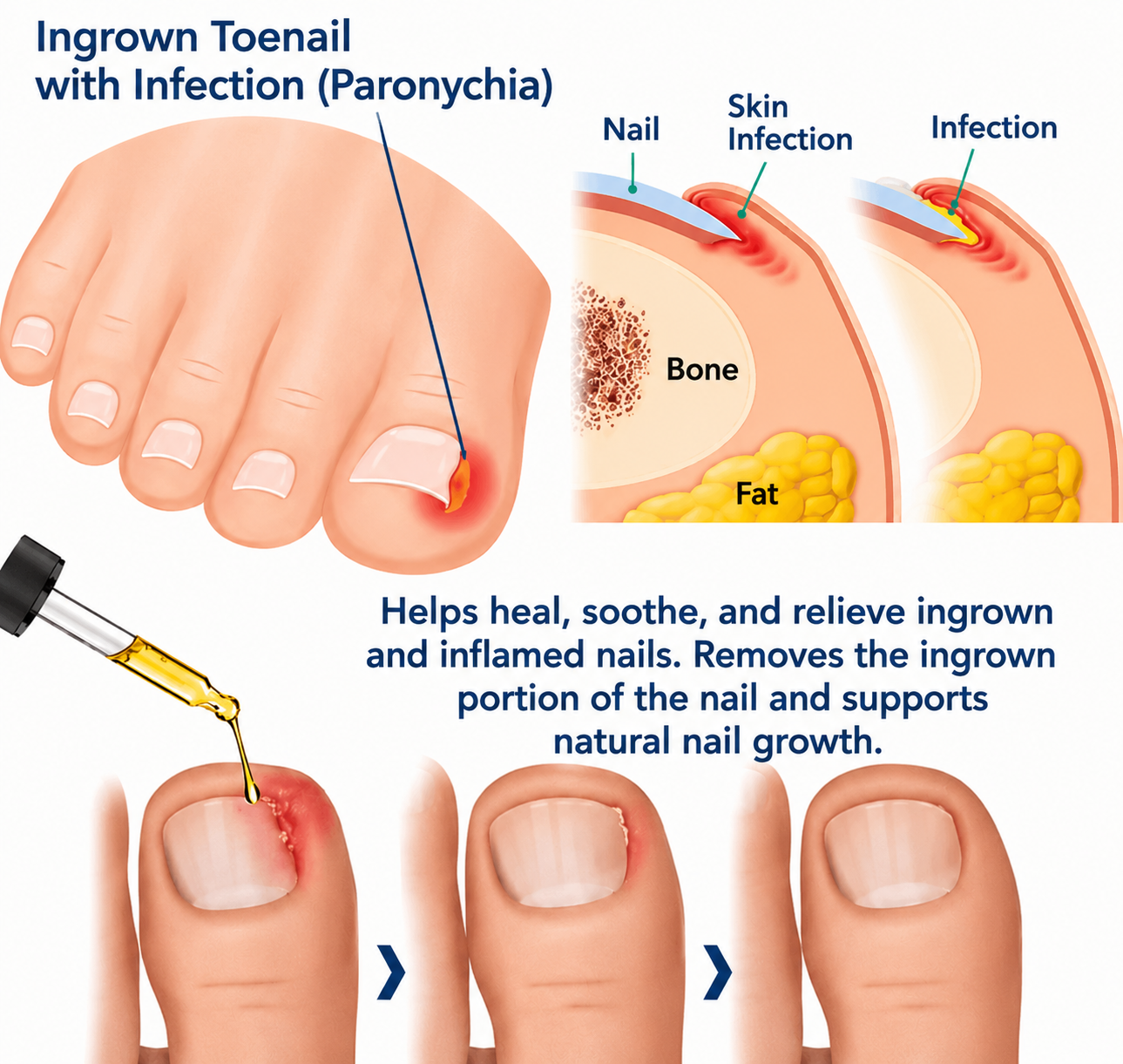 Revive Your Nails: Healing Serum for Healthy Growth